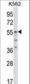 ODC1 / Ornithine Decarboxylase Antibody - ODC1 Antibody western blot of K562 cell line lysates (35 ug/lane). The ODC1 antibody detected the ODC1 protein (arrow).