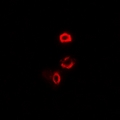OGDH Antibody - Immunofluorescent analysis of OGDH staining in U2OS cells. Formalin-fixed cells were permeabilized with 0.1% Triton X-100 in TBS for 5-10 minutes and blocked with 3% BSA-PBS for 30 minutes at room temperature. Cells were probed with the primary antibody in 3% BSA-PBS and incubated overnight at 4 deg C in a humidified chamber. Cells were washed with PBST and incubated with a DyLight 594-conjugated secondary antibody (red) in PBS at room temperature in the dark.