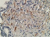 OGFOD1 Antibody - IHC of paraffin-embedded Human prostate tissue using anti-OGFOD1 mouse monoclonal antibody.