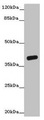 OGFOD2 Antibody - Western blot All lanes: OGFOD2 antibody at 3µg/ml + Mouse liver tissue Secondary Goat polyclonal to rabbit IgG at 1/10000 dilution Predicted band size: 39, 33, 15, 21 kDa Observed band size: 39 kDa