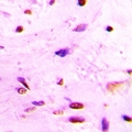 OGG1 Antibody - IHC-P with FFPE human brain samples.