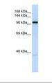 OGT / O-GLCNAC Antibody - Fetal heart lysate. Antibody concentration: 1.0 ug/ml. Gel concentration: 6-18%.  This image was taken for the unconjugated form of this product. Other forms have not been tested.