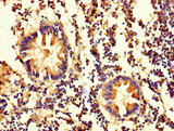 OLA1 Antibody - Immunohistochemistry of paraffin-embedded human appendix tissue using OLA1 Antibody at dilution of 1:100
