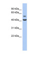OLFML1 Antibody - OLFML1 antibody Western blot of Fetal Muscle lysate. This image was taken for the unconjugated form of this product. Other forms have not been tested.