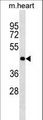 OLIG2 Antibody - OLIG2 Antibody western blot of mouse heart tissue lysates (35 ug/lane). The OLIG2 antibody detected the OLIG2 protein (arrow).