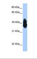 OLIG2 Antibody - Transfected 293T cell lysate. Antibody concentration: 1.0 ug/ml. Gel concentration: 12%.  This image was taken for the unconjugated form of this product. Other forms have not been tested.