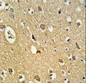 OMD / Osteomodulin Antibody - Formalin-fixed and paraffin-embedded human brain tissue reacted with OMD Antibody , which was peroxidase-conjugated to the secondary antibody, followed by DAB staining. This data demonstrates the use of this antibody for immunohistochemistry; clinical relevance has not been evaluated.