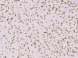 ONECUT1 / HNF6 Antibody - Immunochemical staining ONECUT1 in mouse brain with rabbit polyclonal antibody at 1:1000 dilution, formalin-fixed paraffin embedded sections.