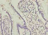 OOSP2 / PLAC1L Antibody - Immunohistochemistry of paraffin-embedded human small intestine tissue using antibody at dilution of 1:100.