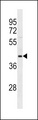 OPCML / OBCAM Antibody - OPCML Antibody western blot of 293 cell line lysates (35 ug/lane). The OPCML antibody detected the OPCML protein (arrow).