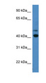 OPN1SW / Blue Opsin Antibody - OPN1SW antibody Western blot of A549 cell lysate.  This image was taken for the unconjugated form of this product. Other forms have not been tested.