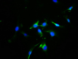 OPN1SW / Blue Opsin Antibody - Immunofluorescence staining of U251 cells with OPN1SW Antibody at 1:100, counter-stained with DAPI. The cells were fixed in 4% formaldehyde, permeabilized using 0.2% Triton X-100 and blocked in 10% normal Goat Serum. The cells were then incubated with the antibody overnight at 4°C. The secondary antibody was Alexa Fluor 488-congugated AffiniPure Goat Anti-Rabbit IgG(H+L).
