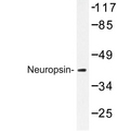 OPN5 / Neuropsin Antibody - Western blot of Neuropsin (Q286) pAb in extracts from Jurkat cells.
