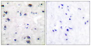 OPRM1 / Mu Opioid Receptor Antibody - Immunohistochemistry analysis of paraffin-embedded human brain tissue, using Opioid Receptor Antibody. The picture on the right is blocked with the synthesized peptide.