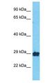 OR10A2 Antibody - OR10A2 antibody Western Blot of RPMI-8226. Antibody dilution: 1 ug/ml.  This image was taken for the unconjugated form of this product. Other forms have not been tested.