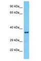 OR10A7 Antibody - OR10A7 antibody Western Blot of A549. Antibody dilution: 1 ug/ml.  This image was taken for the unconjugated form of this product. Other forms have not been tested.