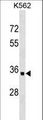 OR10AD1 Antibody - OR10AD1 Antibody western blot of K562 cell line lysates (35 ug/lane). The OR10AD1 antibody detected the OR10AD1 protein (arrow).