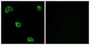OR10K1+2 Antibody - Immunofluorescence analysis of LOVO cells, using OR10K1/10K2 Antibody. The picture on the right is blocked with the synthesized peptide.