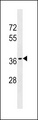 OR10T2 Antibody - OR10T2 Antibody western blot of T47D cell line lysates (35 ug/lane). The OR10T2 antibody detected the OR10T2 protein (arrow).