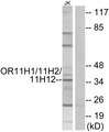 OR11H1+2+12 Antibody - Western blot analysis of lysates from Jurkat cells, using OR11H1/11H2/11H12 Antibody. The lane on the right is blocked with the synthesized peptide.