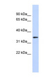OR13C5 Antibody - OR13C5 antibody Western blot of Placenta lysate. This image was taken for the unconjugated form of this product. Other forms have not been tested.