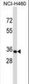 OR14C36 / OR5BF1 Antibody - OR14C36 Antibody western blot of NCI-H460 cell line lysates (35 ug/lane). The OR14C36 antibody detected the OR14C36 protein (arrow).