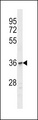 OR1C1 Antibody - OR1C1 Antibody western blot of Jurkat cell line lysates (35 ug/lane). The OR1C1 Antibody detected the OR1C1 protein (arrow).