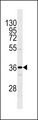 OR1I1 Antibody - OR1I1 Antibody western blot of MDA-MB231 cell line lysates (35 ug/lane). The OR1I1 antibody detected the OR1I1 protein (arrow).