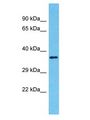 OR2A1 Antibody - OR2A1 antibody Western Blot of Fetal Kidney. Antibody dilution: 1 ug/ml.  This image was taken for the unconjugated form of this product. Other forms have not been tested.