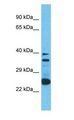 OR2A12 Antibody - OR2A12 antibody Western Blot of 721_B. Antibody dilution: 1 ug/ml.  This image was taken for the unconjugated form of this product. Other forms have not been tested.