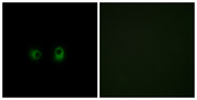 OR2AK2 Antibody - Immunofluorescence analysis of COS7 cells, using OR2AK2 Antibody. The picture on the right is blocked with the synthesized peptide.
