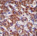 OR2B11 Antibody - OR2B11 Antibody immunohistochemistry of formalin-fixed and paraffin-embedded human liver tissue followed by peroxidase-conjugated secondary antibody and DAB staining.