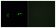 OR2C1 Antibody - Immunofluorescence analysis of A549 cells, using OR2C1 Antibody. The picture on the right is blocked with the synthesized peptide.