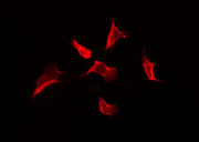 OR2I1P Antibody - Staining HuvEc cells by IF/ICC. The samples were fixed with PFA and permeabilized in 0.1% Triton X-100, then blocked in 10% serum for 45 min at 25°C. The primary antibody was diluted at 1:200 and incubated with the sample for 1 hour at 37°C. An Alexa Fluor 594 conjugated goat anti-rabbit IgG (H+L) Ab, diluted at 1/600, was used as the secondary antibody.