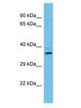 OR2T12 Antibody - OR2T12 antibody Western Blot of HT1080. Antibody dilution: 1 ug/ml.  This image was taken for the unconjugated form of this product. Other forms have not been tested.