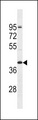 OR2T5 Antibody - OR2T5 Antibody western blot of NCI-H292 cell line lysates (35 ug/lane). The OR2T5 Antibody detected the OR2T5 protein (arrow).