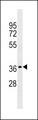 OR2W1 Antibody - OR2W1 Antibody western blot of A549 cell line lysates (35 ug/lane). The OR2W1 antibody detected the OR2W1 protein (arrow).
