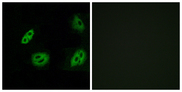 OR4B1 Antibody - Immunofluorescence analysis of A549 cells, using OR4B1 Antibody. The picture on the right is blocked with the synthesized peptide.
