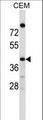 OR4C16 Antibody - OR4C16 Antibody western blot of CEM cell line lysates (35 ug/lane). The OR4C16 antibody detected the OR4C16 protein (arrow).
