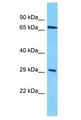 OR4D10 Antibody - OR4D10 antibody Western Blot of HepG2. Antibody dilution: 1 ug/ml.  This image was taken for the unconjugated form of this product. Other forms have not been tested.