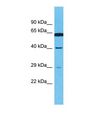 OR4E2 Antibody - Western blot of Human MCF7. OR4E2 antibody dilution 1.0 ug/ml.  This image was taken for the unconjugated form of this product. Other forms have not been tested.