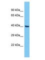 OR4F21 Antibody - OR4F21 antibody Western Blot of MCF7. Antibody dilution: 1 ug/ml.  This image was taken for the unconjugated form of this product. Other forms have not been tested.