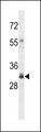 OR4F3 Antibody - OR4F16 Antibody western blot of Y79 cell line lysates (35 ug/lane). The OR4F16 antibody detected the OR4F16 protein (arrow).