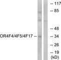 OR4F4+5+17 Antibody - Western blot analysis of lysates from MCF-7 cells, using OR4F4/4F5/4F17 Antibody. The lane on the right is blocked with the synthesized peptide.