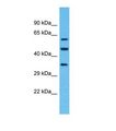 OR4F6 Antibody - Western blot of Human RPMI-8226. OR4F6 antibody dilution 1.0 ug/ml.  This image was taken for the unconjugated form of this product. Other forms have not been tested.
