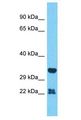 OR51A2 Antibody - OR51A2 antibody Western Blot of RPMI-8226. Antibody dilution: 1 ug/ml.  This image was taken for the unconjugated form of this product. Other forms have not been tested.