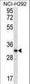 OR51L1 Antibody - OR51L1 Antibody western blot of NCI-H292 cell line lysates (35 ug/lane). The OR51L1 antibody detected the OR51L1 protein (arrow).