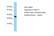 OR51V1 Antibody -  This image was taken for the unconjugated form of this product. Other forms have not been tested.
