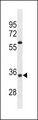 OR52A5 Antibody - OR52A5 Antibody western blot of Jurkat cell line lysates (35 ug/lane). The OR52A5 antibody detected the OR52A5 protein (arrow).