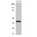 OR52B2 Antibody - Western blot of Olfactory receptor 52B2 antibody